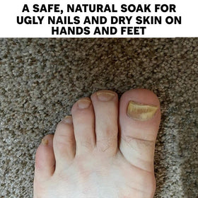 Long Creek Herbs heel softening lifestyle scene showing smoother, hydrated feet