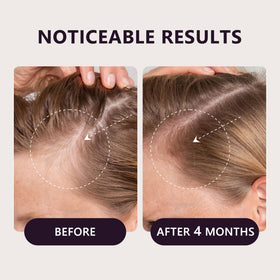 LONGCCI dropper applying serum to scalp illustrating precise targeted application