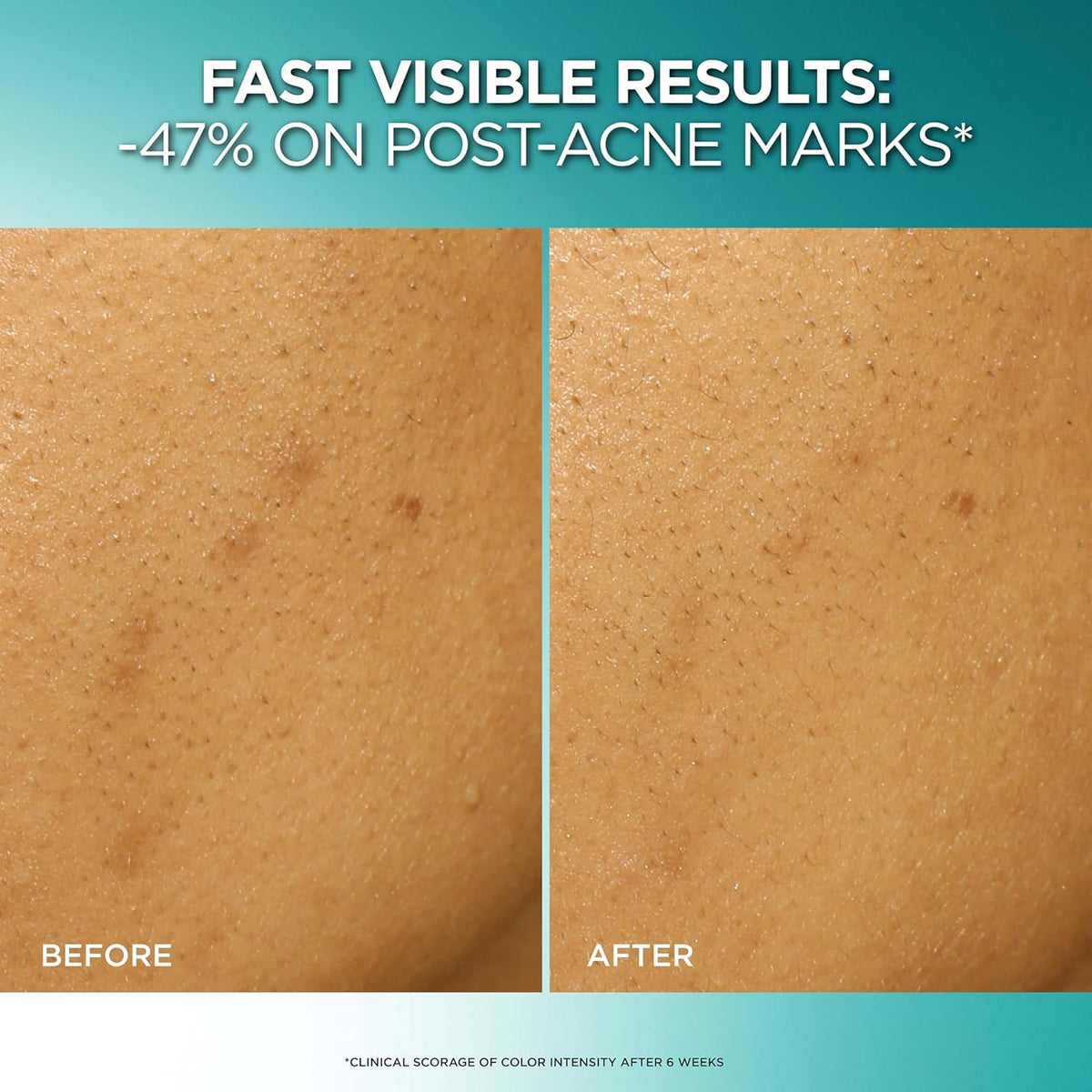 L'Oreal Paris dropper dispensing product, highlighting precise application benefit