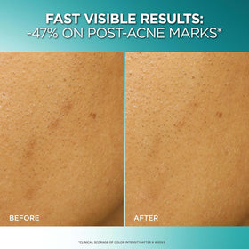 L'Oreal Paris dropper dispensing product, highlighting precise application benefit