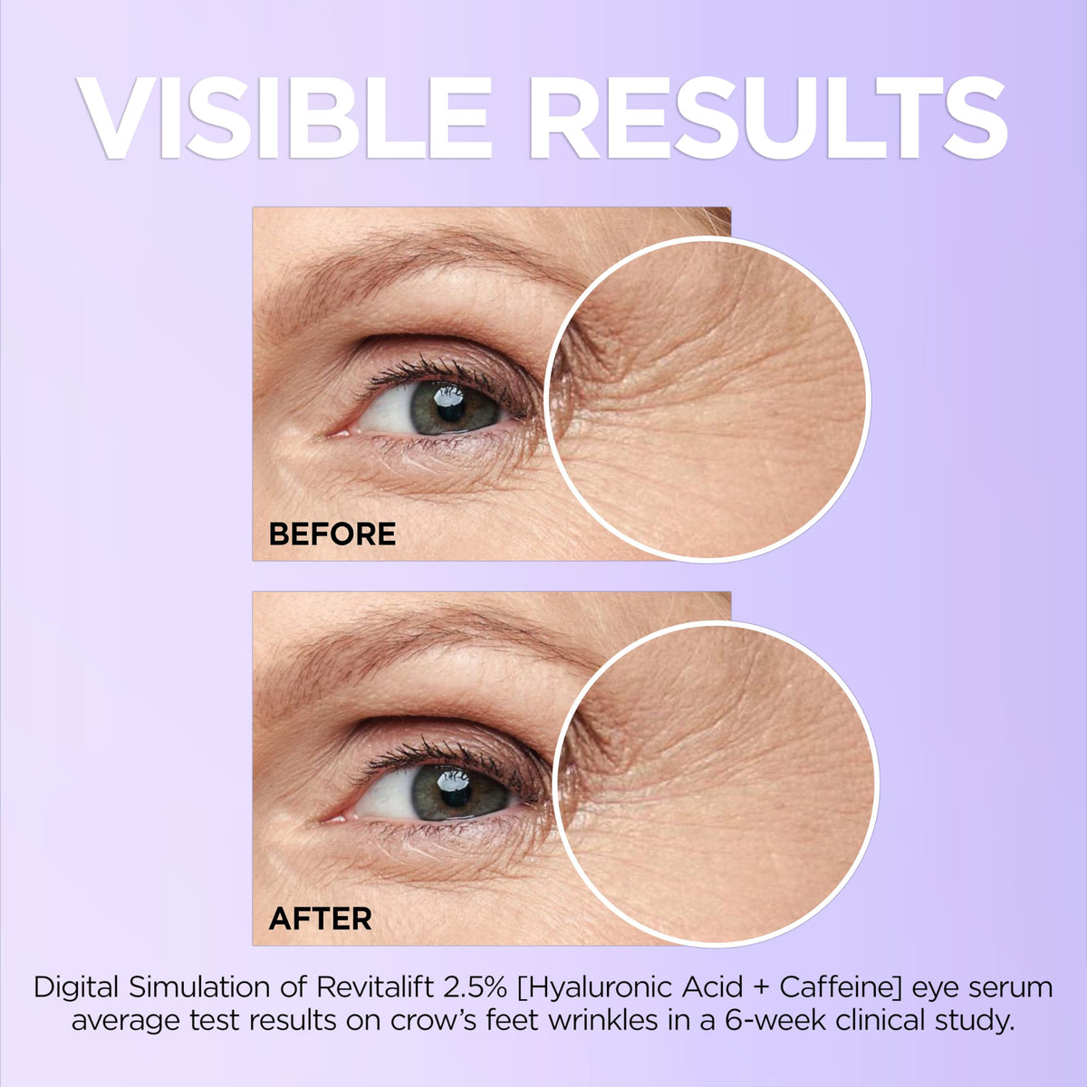 L'Oreal Paris label ingredient panel highlighting hyaluronic acid and caffeine