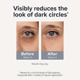 loxadz before and after under-eye brightening for visible improvement