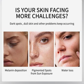 LRUSEIFE cream applied to cheek targeting dark spot, illustrating focused correction benefit