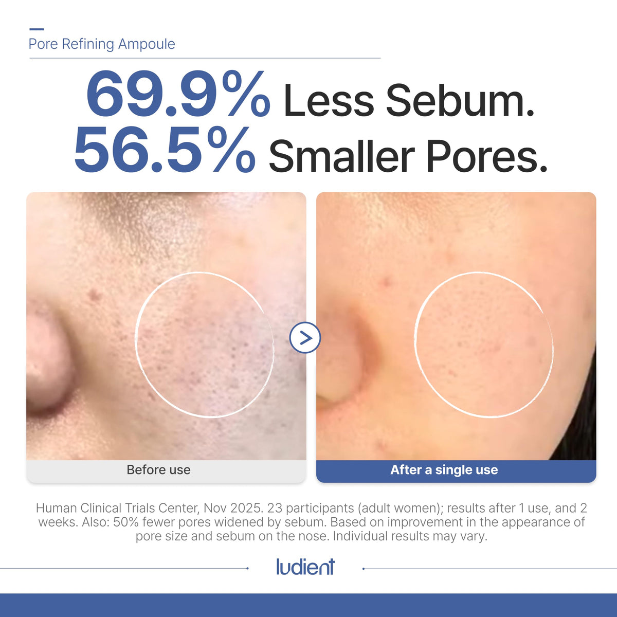 ludient dropper releasing serum texture highlighting lightweight absorption benefit