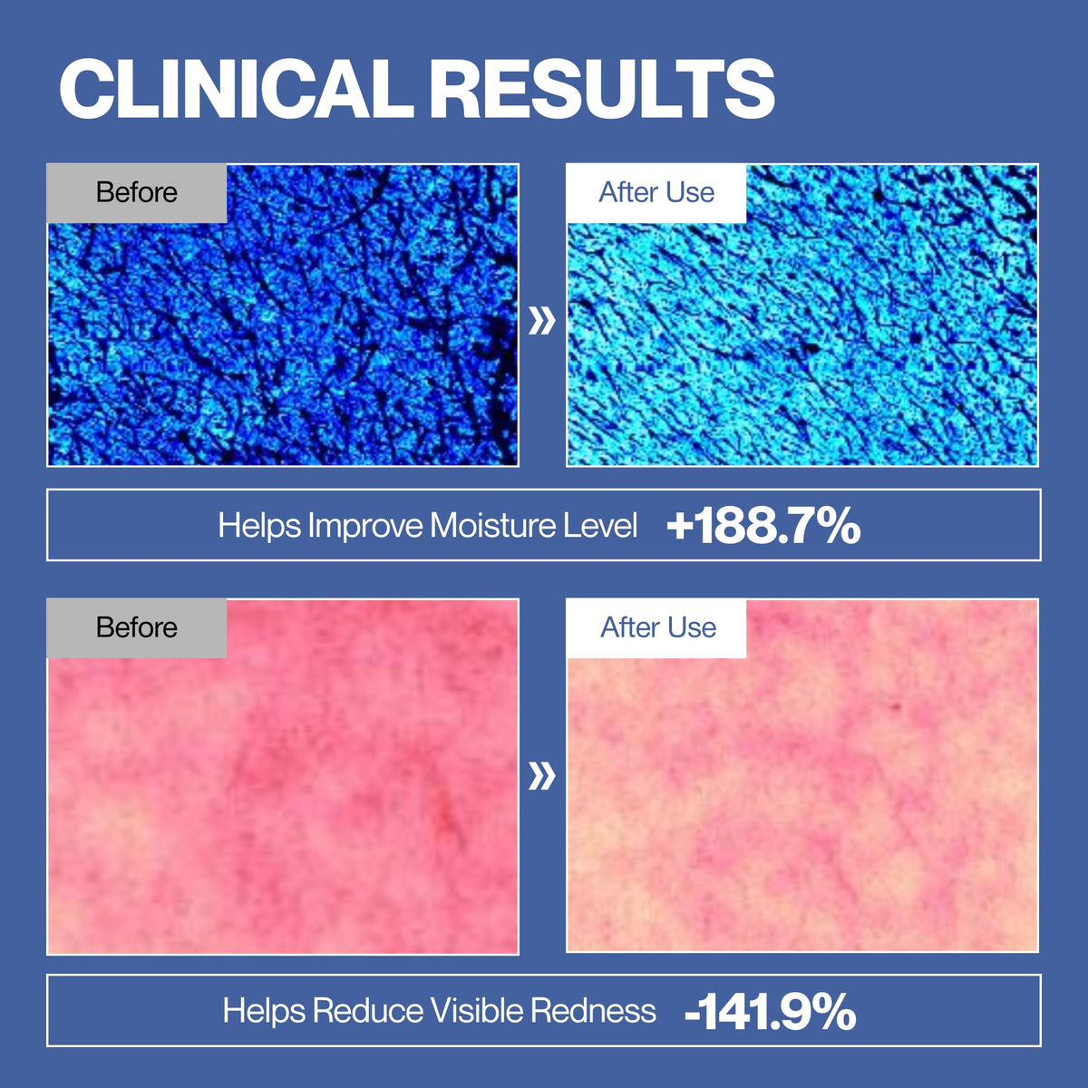 ludient peptide complex capsule close-up emphasizing firming support