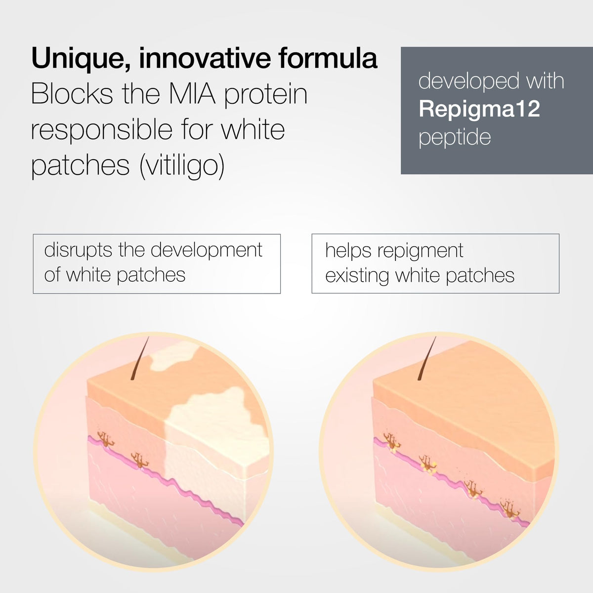 LULLAGE being applied to hands demonstrating targeted patch coverage benefit