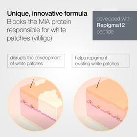 LULLAGE being applied to hands demonstrating targeted patch coverage benefit