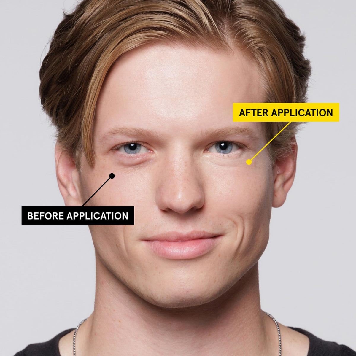 Lumin before and after under-eye comparison showing reduced darkness appearance