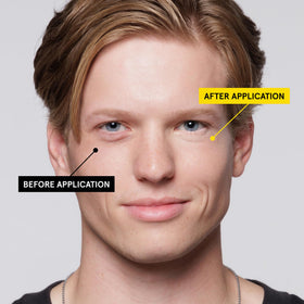 Lumin before and after under-eye comparison showing reduced darkness appearance