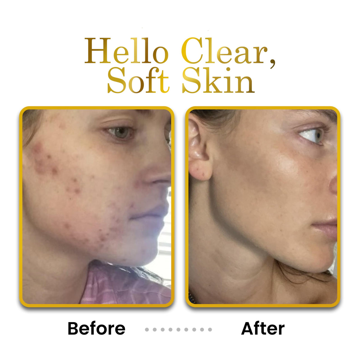 Luxe Beauty applied to face neck hands illustrating non-greasy smooth finish benefit