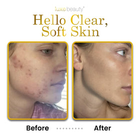 LUXE Beauty applied to face in morning routine demonstrating fast absorption benefit