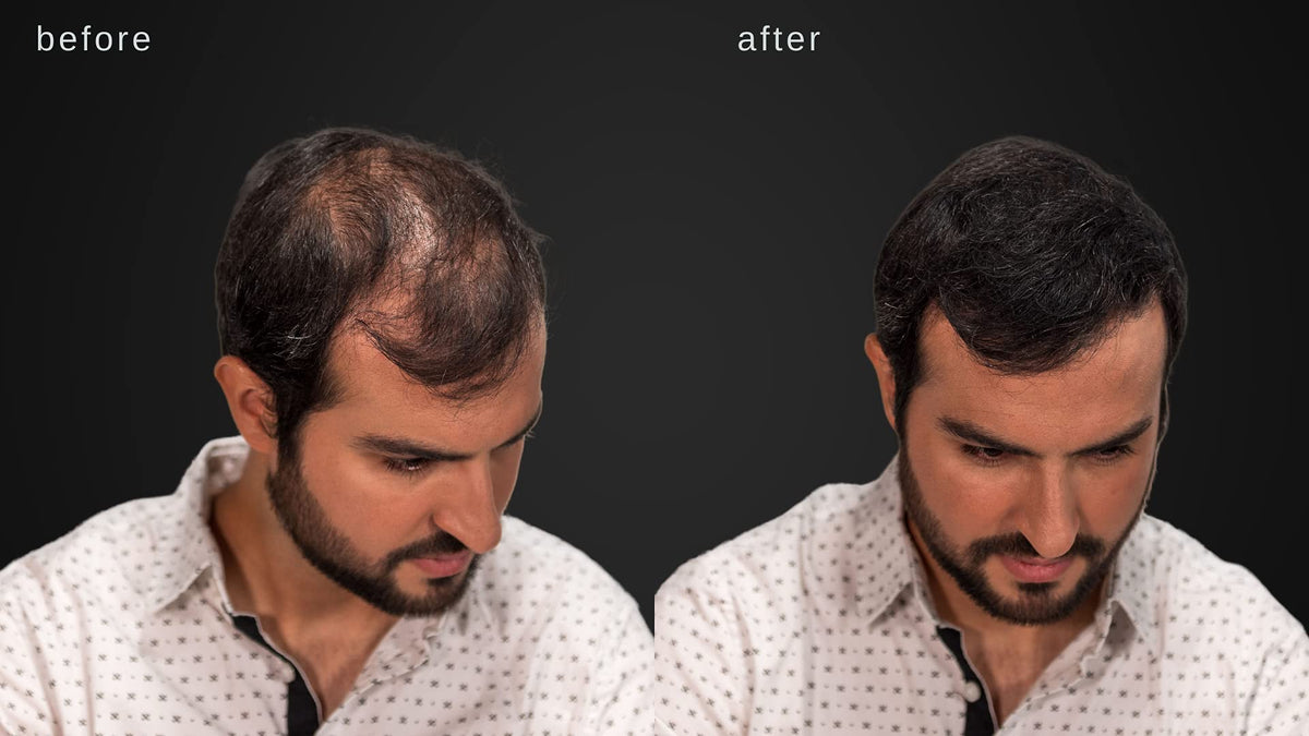 LUXE before and after shot highlighting dramatic concealment of thinning areas