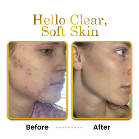 LUXELOTION neck and hands usage demonstrating smooth skin feel benefit