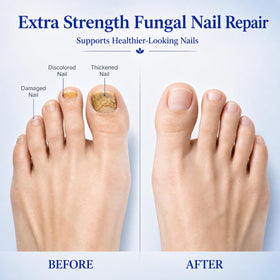 Lyssera pen in hand applying to nail for targeted treatment