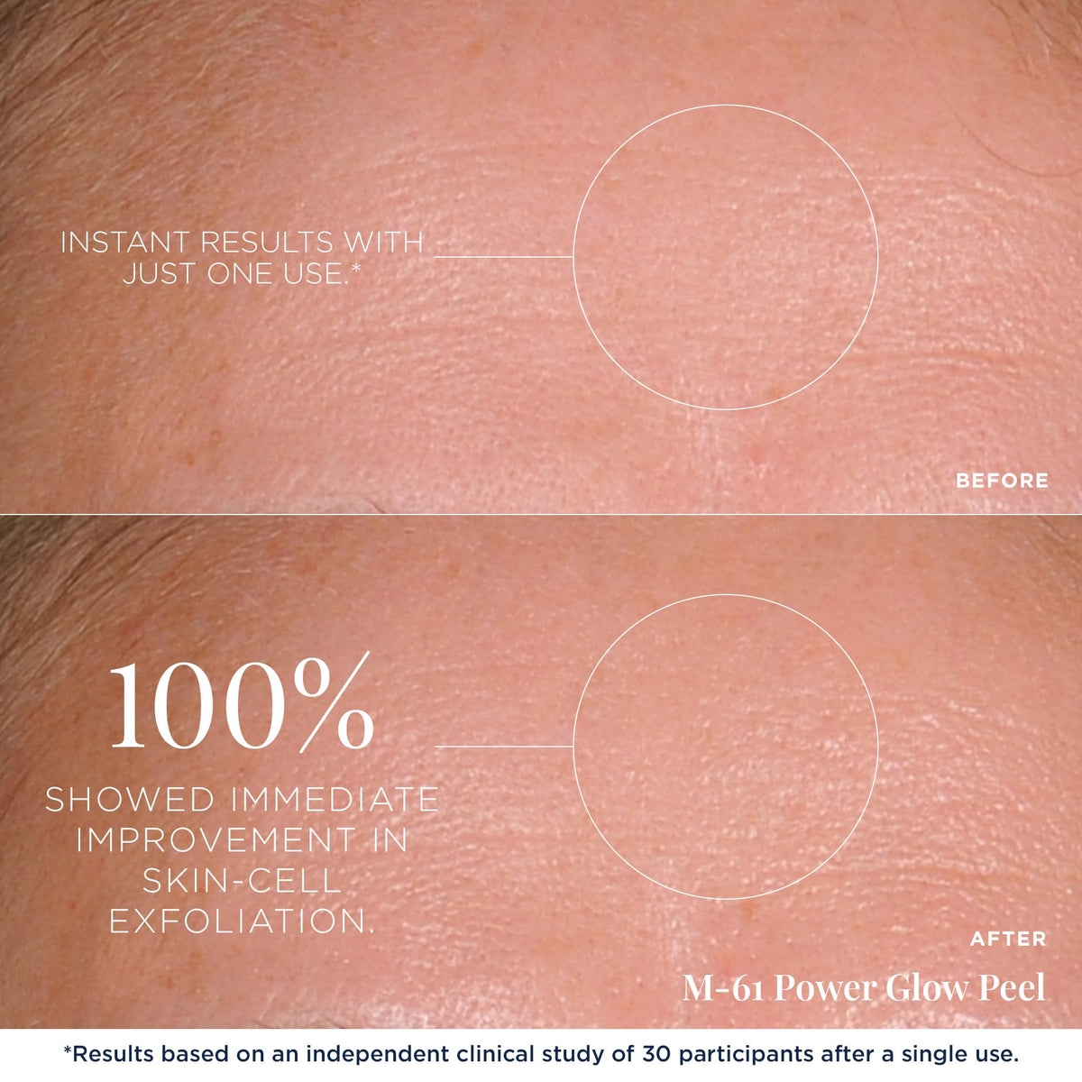 m-61 pad in hand being applied showing quick one-minute benefit