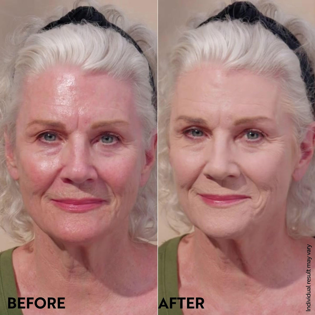 M. Asam split-face before and after showing reduced redness and matte result