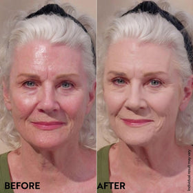 M. Asam split-face before and after showing reduced redness and matte result