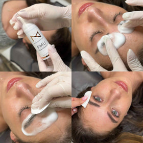 M cleanser poured on cotton pad to lift pigment and debris