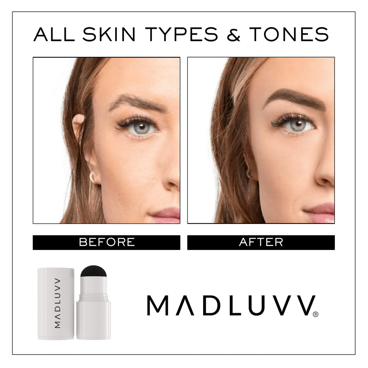 MADLUVV filling beard patch showing discreet coverage for confidence