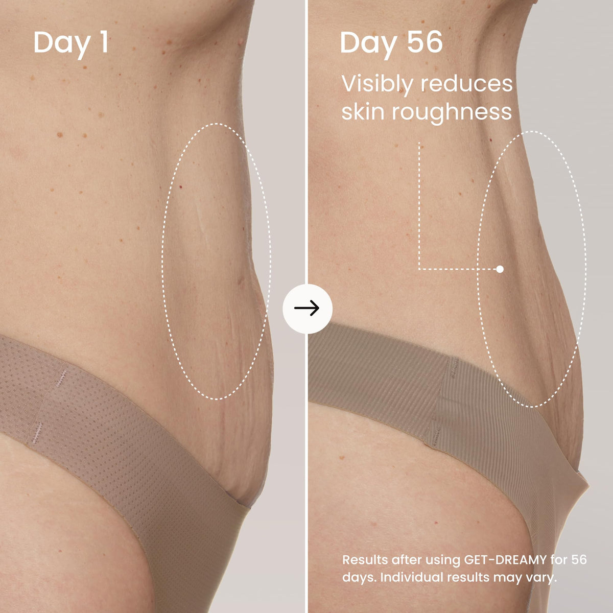 MAËLYS cream being applied to thigh illustrating easy absorption benefit