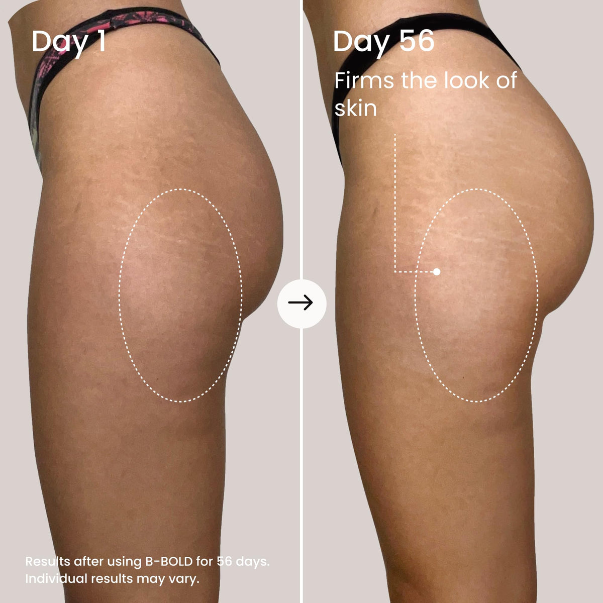 MAËLYS cream being massaged on skin for smoother, hydrated appearance