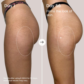 MAËLYS cream being massaged on skin for smoother, hydrated appearance