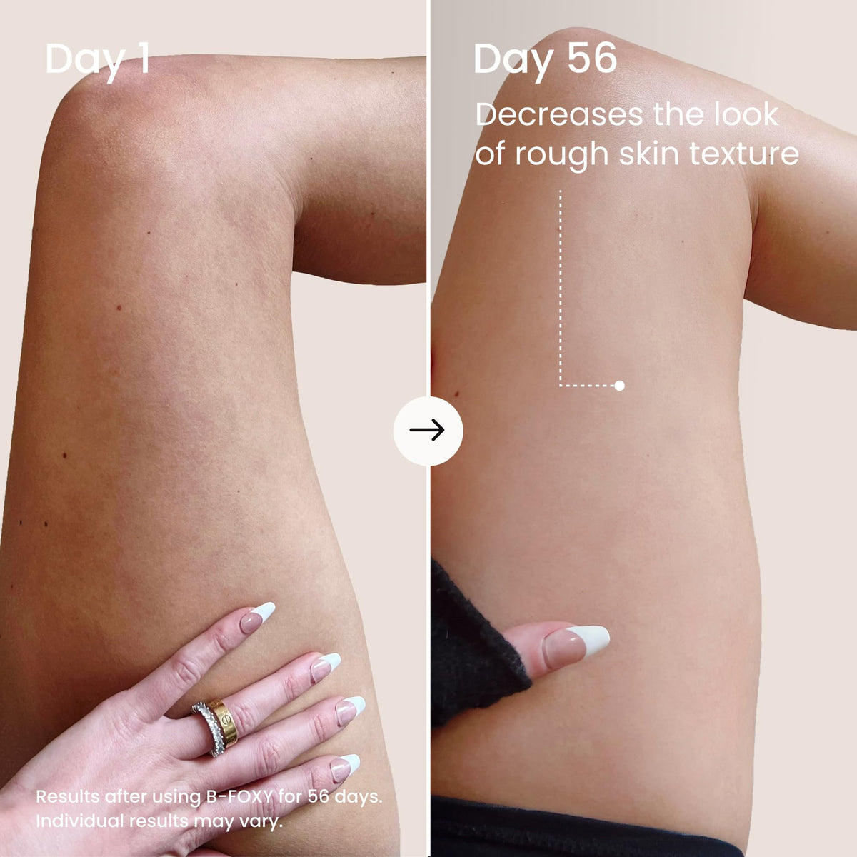 MAËLYS B-FOXY being applied to inner thigh to reduce chafing and improve tone
