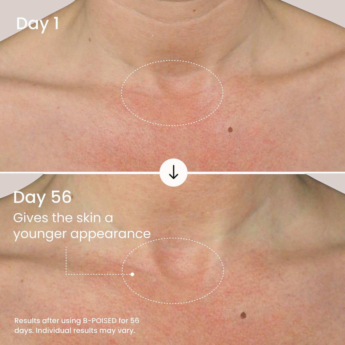MAËLYS application on neck showing product use and smoother-looking décolleté benefit