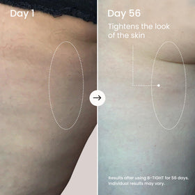 Applying MAËLYS B-TIGHT cream to thigh demonstrating easy massage absorption benefit
