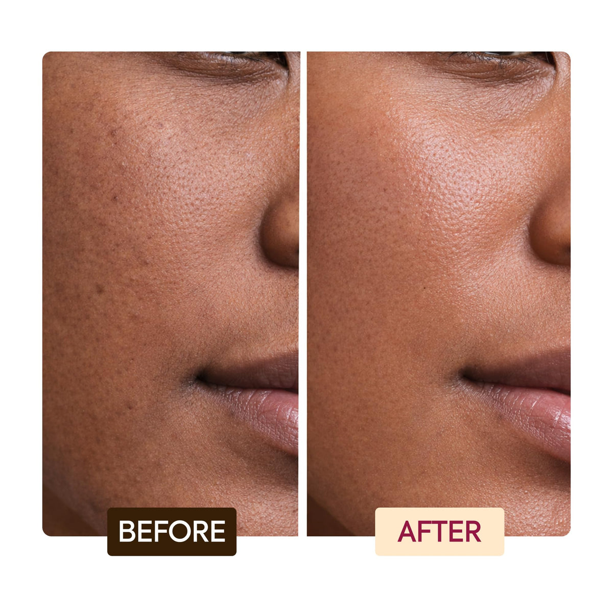 MAKARI Vegeclairine mulberry root visual representing botanical brightening support