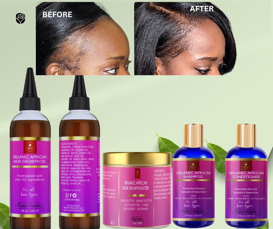 MAKOF BEAUTY applying oil to edges for targeted strengthening