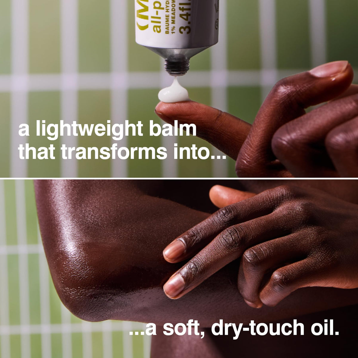 MALIN+GOETZ applied to elbow showing softening and smoothing benefit