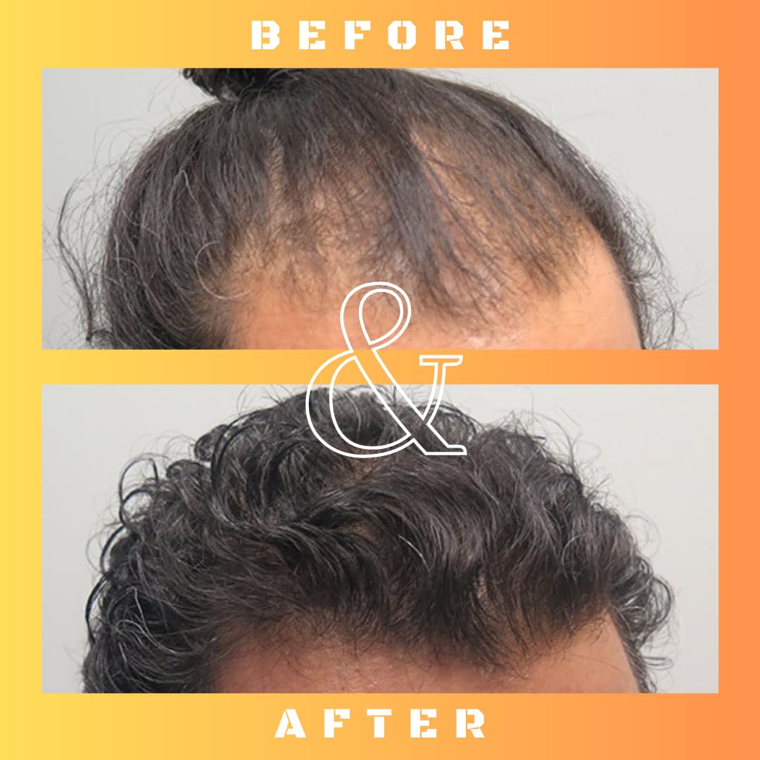 Mane Regain 30ml bottle beside a ruler showing compact size and travel-friendly convenience