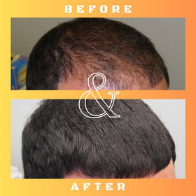 Mane Regain applied to a thinning scalp area demonstrating targeted use to support hair retention