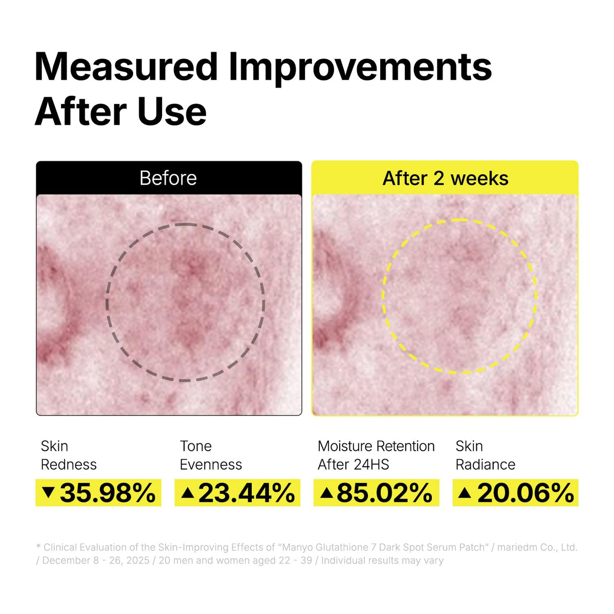 ma:nyo daytime routine with sunscreen showing recommended protection to preserve results