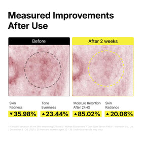 ma:nyo daytime routine with sunscreen showing recommended protection to preserve results