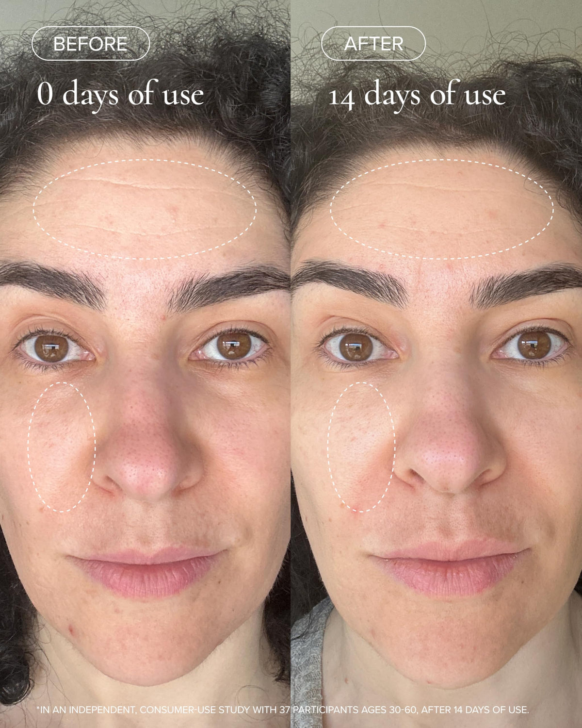 MARA SeaDream applied to neck and décolletage illustrating lift and firmness