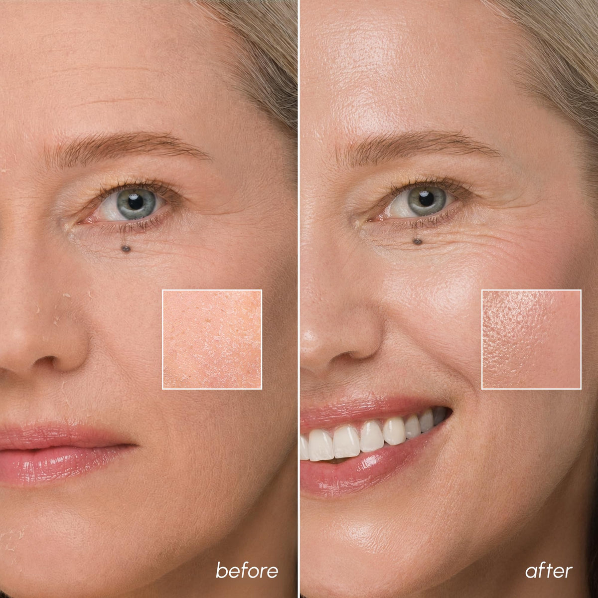 MAREE centella and algae ingredients laid out to highlight soothing benefits