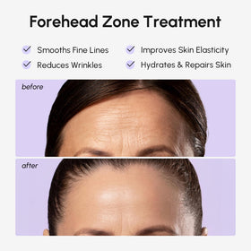 MAREE patch applied on forehead demonstrating discreet wear