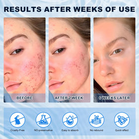 Marianp cream on hand to show product amount and absorbency benefit