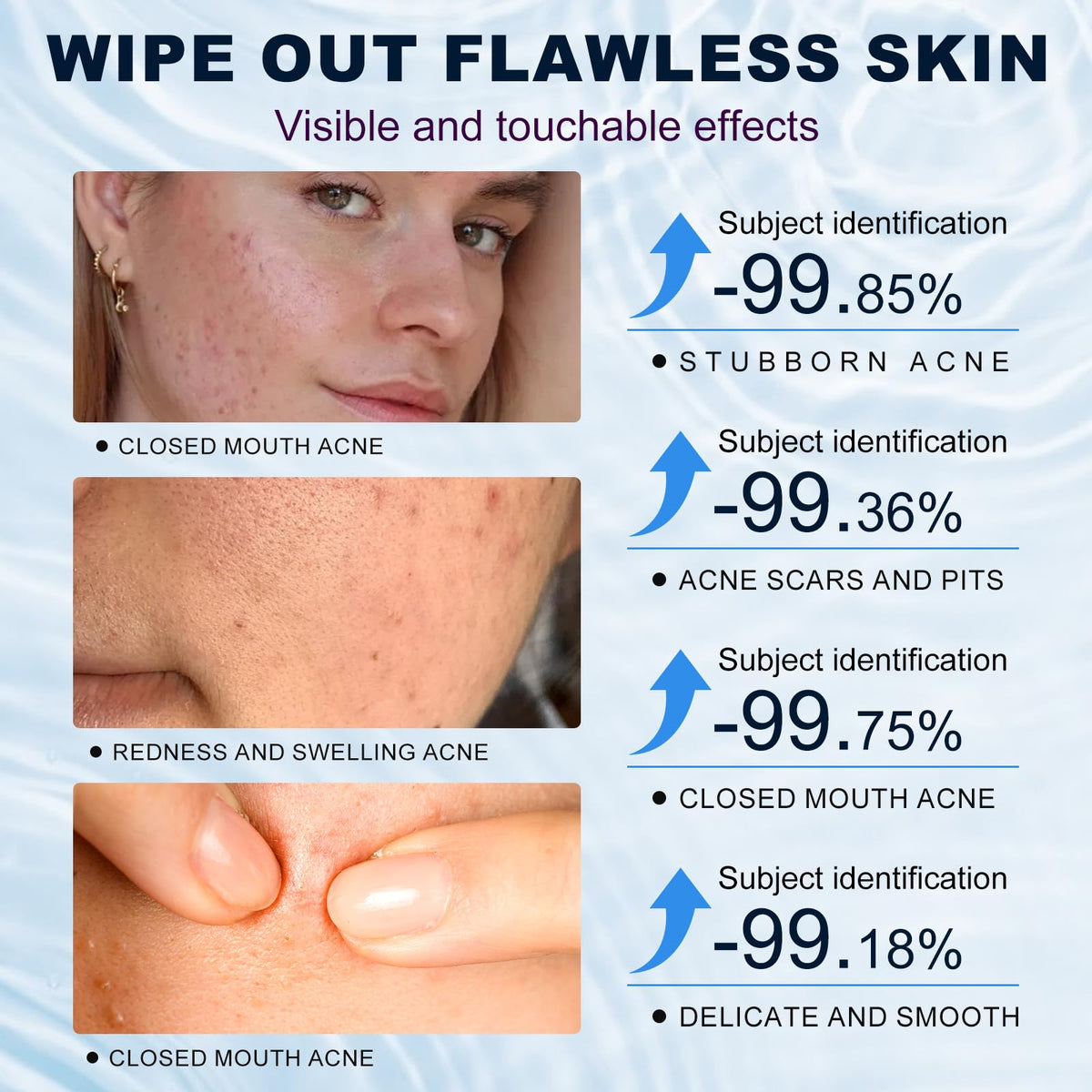 Marianp ingredient list label closeup highlighting 10% azelaic acid strength