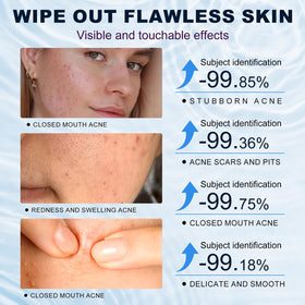 Marianp ingredient list label closeup highlighting 10% azelaic acid strength