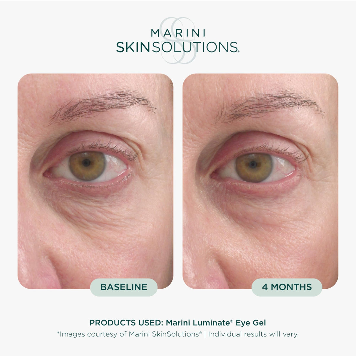 Marini SkinSolutions gel texture swirl showing lightweight, fast-absorbing benefit
