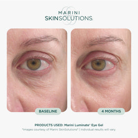 Marini SkinSolutions gel texture swirl showing lightweight, fast-absorbing benefit