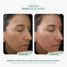 Marini SkinSolutions lotion texture close-up for lightweight absorption