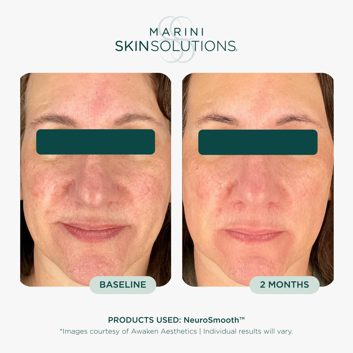 Marini SkinSolutions label close-up highlighting key ingredients and transparency benefit