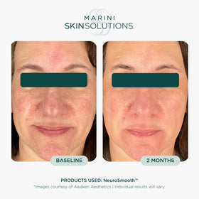 Marini SkinSolutions label close-up highlighting key ingredients and transparency benefit