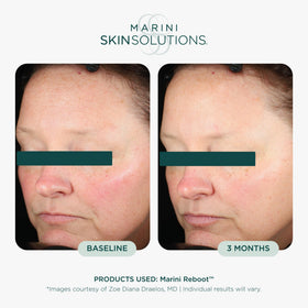 Marini SkinSolutions pump dispenser detail for controlled, hygienic dosing