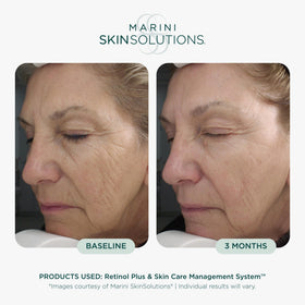 Marini SkinSolutions cream texture on fingertip showing smooth hydration