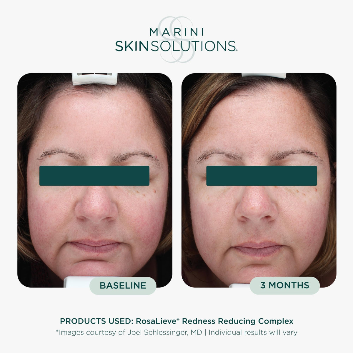 Marini SkinSolutions lotion texture close-up showing lightweight absorbency